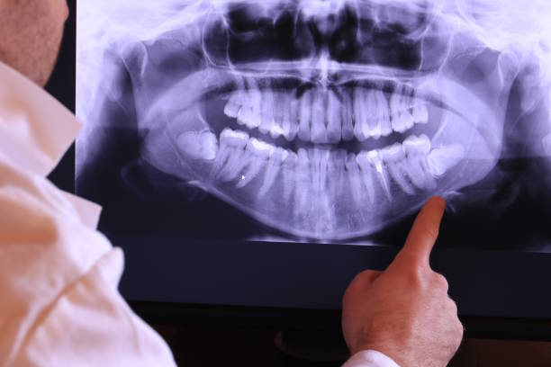 Best Emergency Gum Treatment in Del Aire, CA