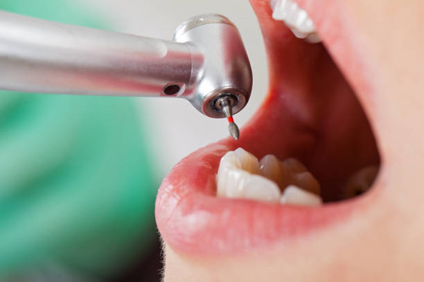 Best Cosmetic Emergency Dentistry in Del Aire, CA